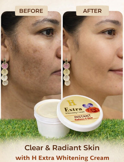 Extra Glow Skin Brightening Cream 🌟